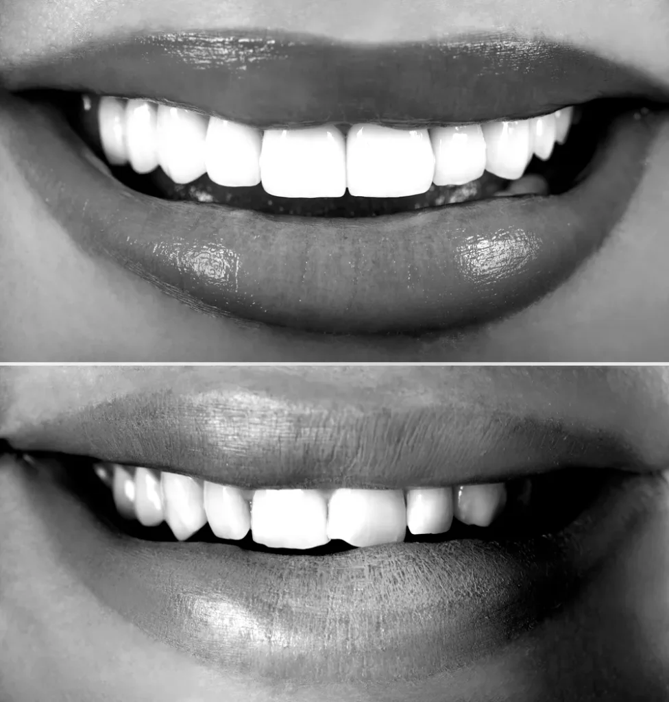 Invisalign and Invisible Orthodontic Options