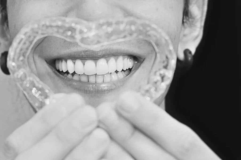 Orthodontic treatments