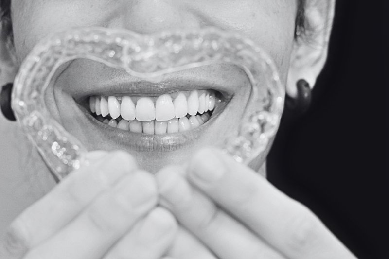invisalign results for adults