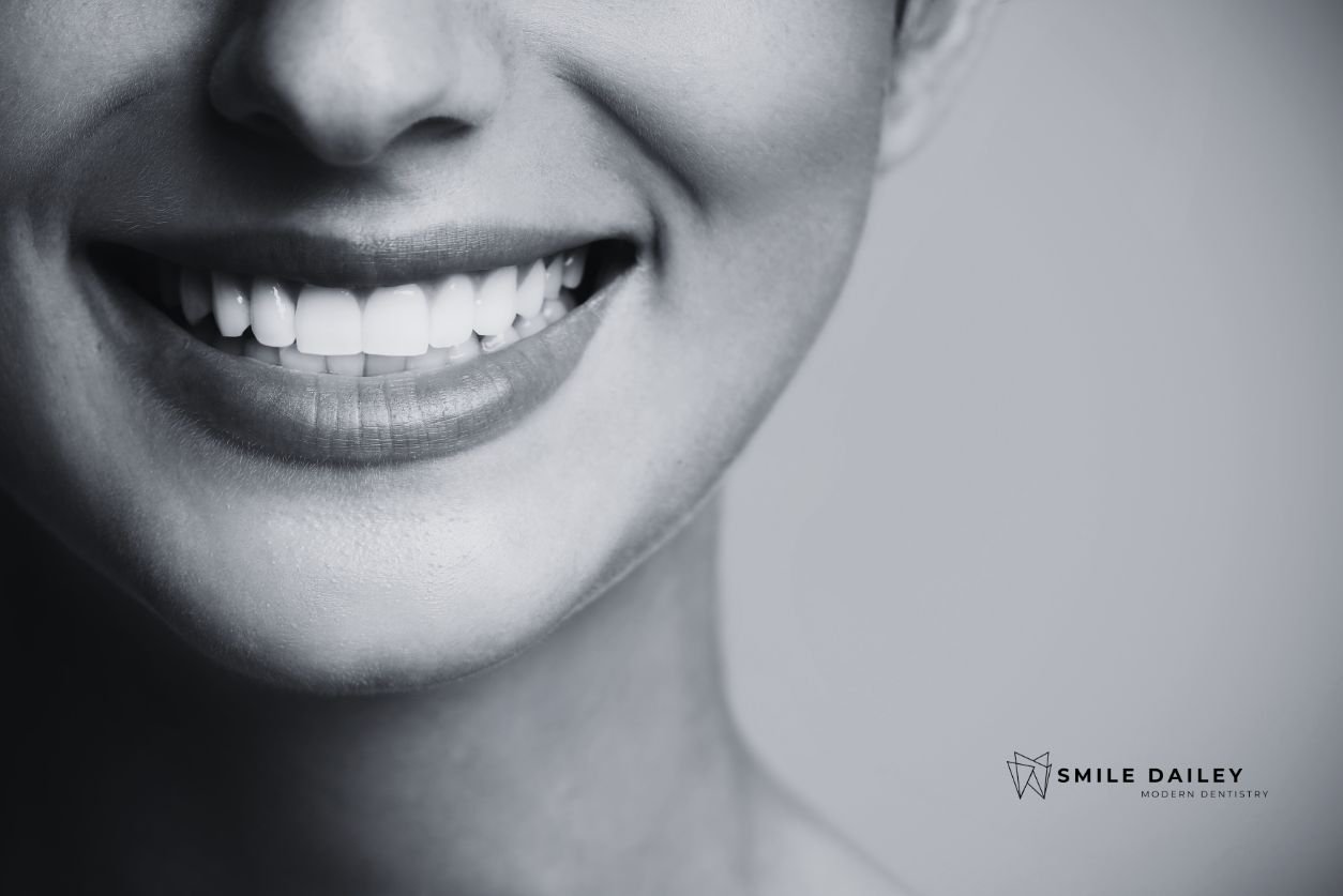 Porcelain vs Composite Veneers: What Are the Key Differences? cover