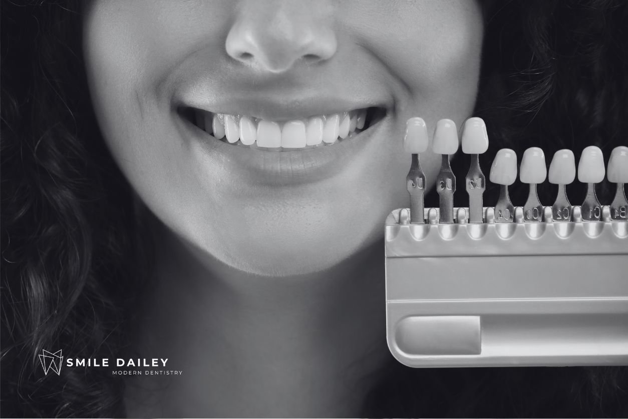 Veneers Pros and Cons: Is This the Right Choice for You cover